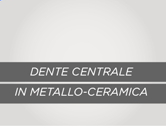 Denti in Metallo e Ceramica